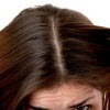 Aceites y Lociones para cabello graso